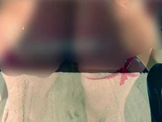 Frau in roten Dessous