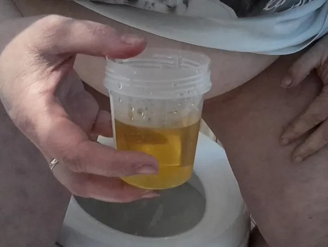 Urinprobe für den Doc