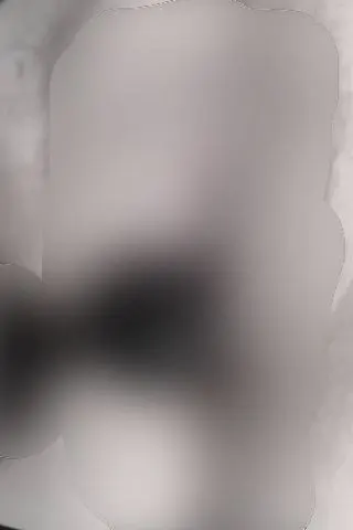 Kugelvideo