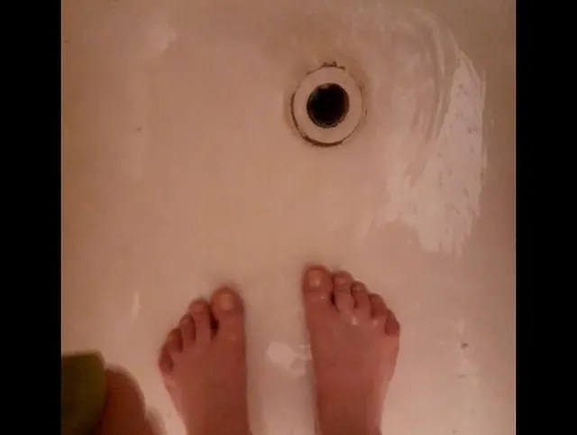 Fußepilation