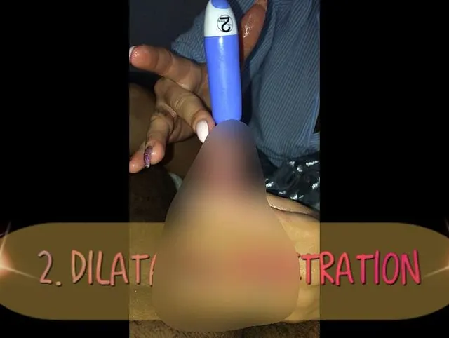 2. Dilatator Penetration