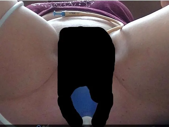 mein Arsch wird mit dem Blasebalg gedehnt