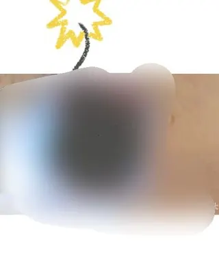 2 Clips // Nahaufnahme Spekulum vom ,,Speculum-Live-Treffen“