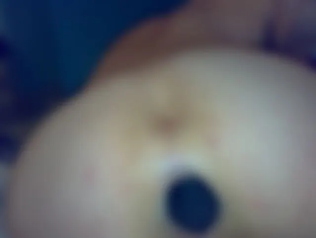 Reinigung