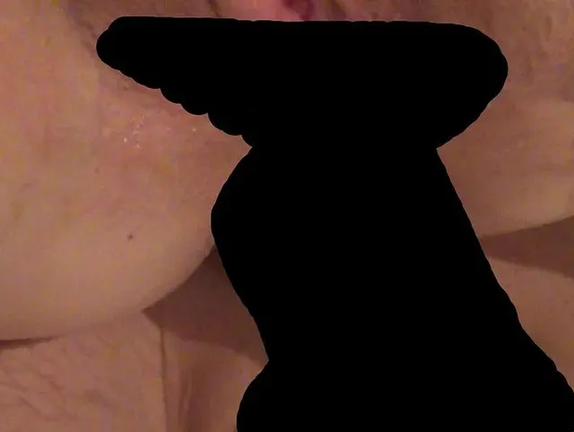 Anal