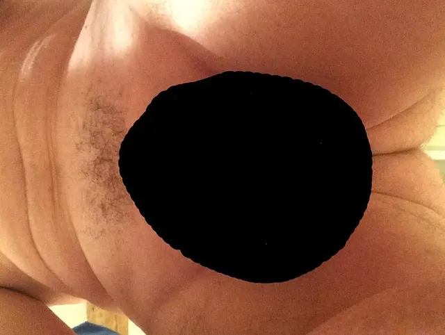 Prostata Massage