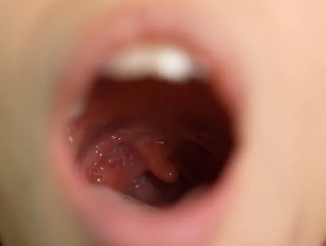 Ich werde Ihnen den Uvula -Fetisch extrem nah zeigen
