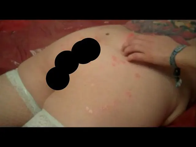 ****** to take hot wax on my back