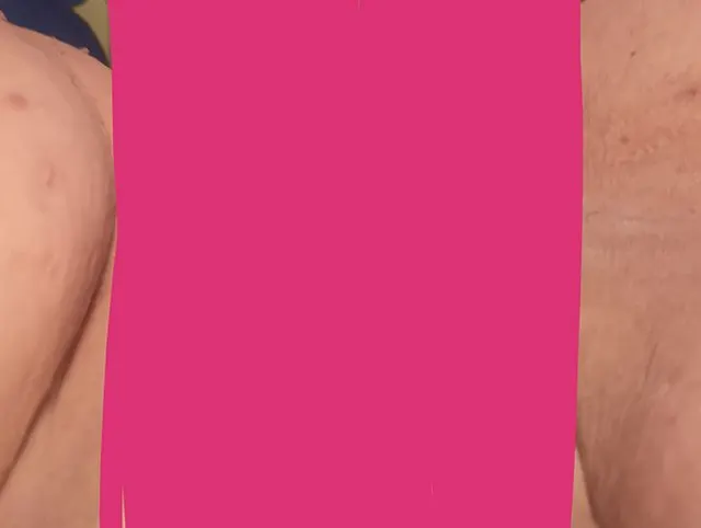 Pussy Haut nah