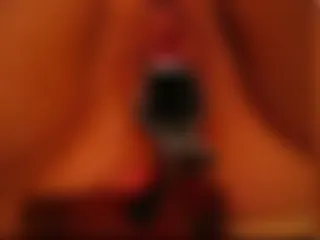 Spekulum
