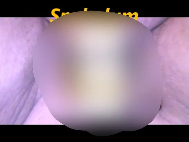 Großaufnahme - Speculum Tag