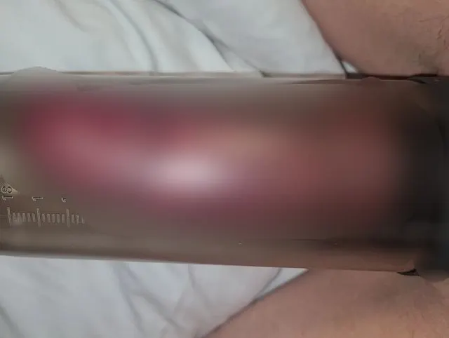 Penispumpen Schulung