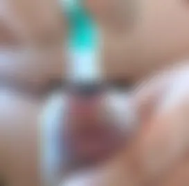 Dilatorspass