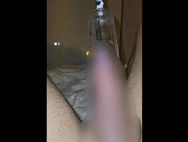 Schwanz Pumpen mit Dilator