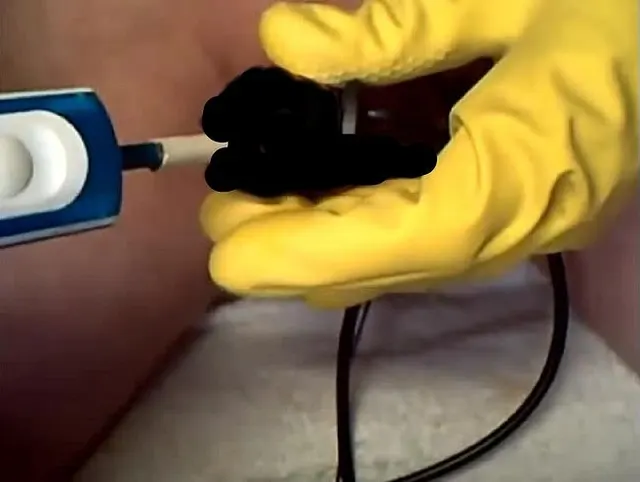 Frau Doktor setzt den Schwanz-Vibrator und Strom ein