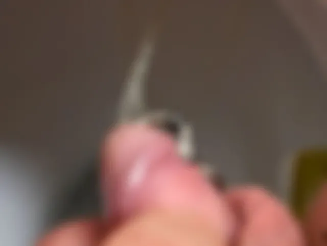 Ring Pissen