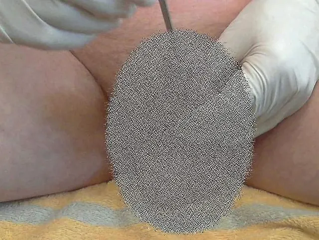 Telekolleg Sounding (Cockstuffing, Urethral Stimulation) Folge 1
