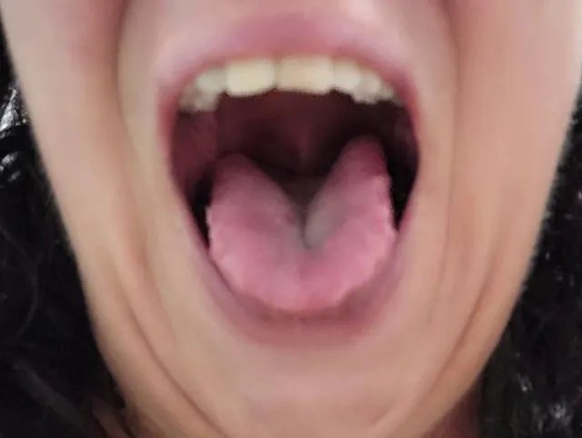 Vore-Fetisch