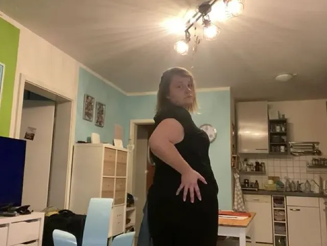 Ich zeige dir meine Amputations Narben!