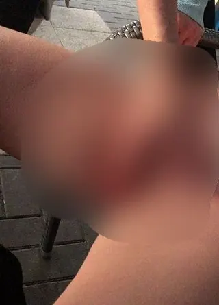 Eiswürfel wurde mir spontan eingeführt ohne Warnung