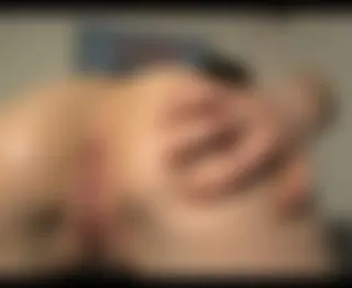 Analfistversuch