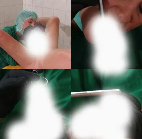 Pissloch Massage - Abspritzen