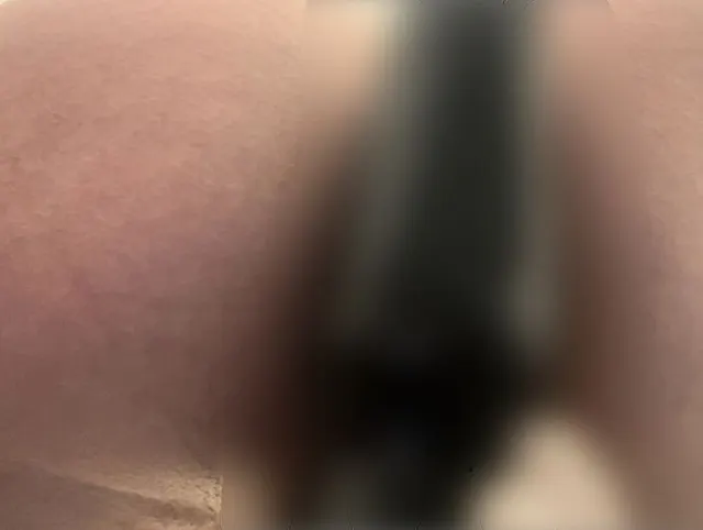 Ganz nah wenn die Rosette mit dem aufblasbaren Plug gedehnt wird