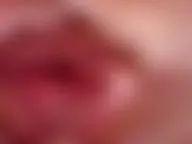 Ich werde untersucht.....User treff.....